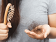 Come si possono infoltire i capelli senza usare la chirurgia
