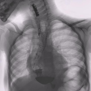 A Torino il 7° Congresso Nazionale della Società Italiana per lo Studio delle Malattie dell’Esofago