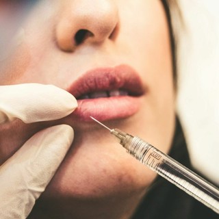 Estetica dello sguardo e terzo superiore del volto: come cancellare i segni di stanchezza senza alterare i lineamenti