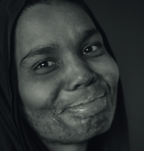 Oltre le cicatrici: l’impegno di Reconstructing Women International in mostra a CAMERA