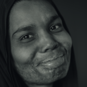 Oltre le cicatrici: l’impegno di Reconstructing Women International in mostra a CAMERA