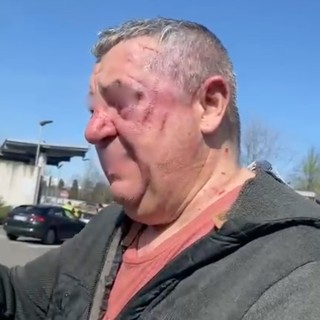 L'uomo ferito a seguito dello scippo al suk della Colletta
