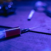 Riboldi attacca: “Assoluta contrarietà all’ipotesi di stanze del buco”