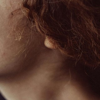 Dermatochirurgia: Come i Trattamenti Chirurgici Possono Migliorare la Tua Pelle