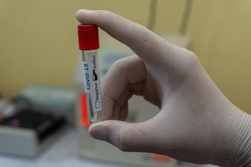 Altri 72 morti per il coronavirus in Piemonte, ma non aumentano le terapie intensive e calano i ricoveri in ospedale
