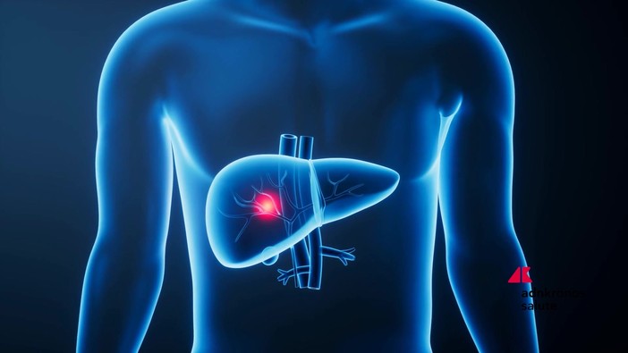 Giornata epatiti, esperti 'terapie efficaci, screening di prossimità per le virali' Giornata epatiti, esperti 'terapie efficaci, screening di prossimità per le virali'