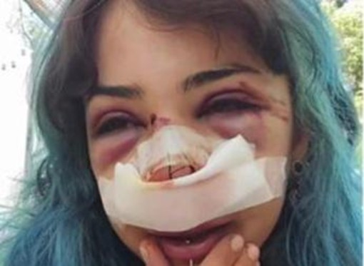 Bari, studentessa picchiata nei bagni denuncia nuovo episodio: "Mi hanno accerchiata" Bari, studentessa picchiata nei bagni denuncia nuovo episodio: "Mi hanno accerchiata"