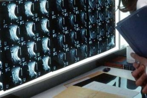 Oltre 500 malattie rare delle ossa, esperti: &quot;Investire in prevenzione e diagnosi&quot;