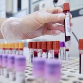 Cancro al seno, oncologi: &quot;Bene test genomici nei nuovi Lea, fare presto&quot;