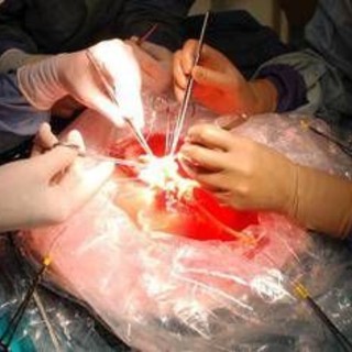 Trapianti, a Padova impiantato il fegato di una 99enne: la donatrice più anziana di sempre