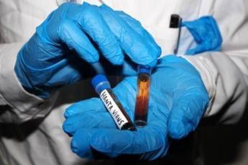 Hantavirus, test negativo per la persona in isolamento in Veneto Hantavirus, test negativo per la persona in isolamento in Veneto