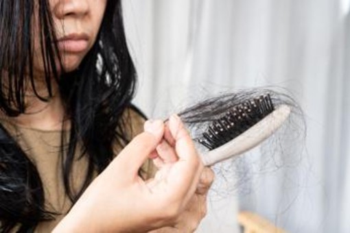 Con nuovi farmaci anti diabete e obesità più rischi di perdere i capelli, lo studio Con nuovi farmaci anti diabete e obesità più rischi di perdere i capelli, lo studio