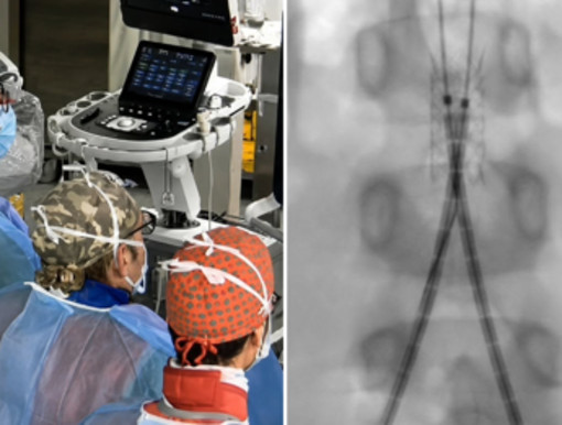 Incidente con un'acquasantiera in chiesa, bimba di 6 anni operata d'urgenza all'aorta a Bari Incidente con un'acquasantiera in chiesa, bimba di 6 anni operata d'urgenza all'aorta a Bari