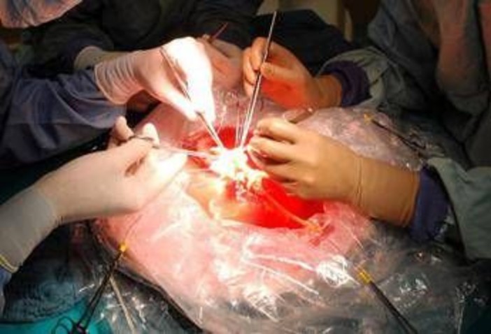 Trapianti, a Padova impiantato il fegato di una 99enne: la donatrice più anziana di sempre