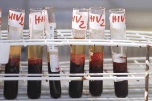 Aids, scoperti 'codici' del sistema immunitario per sospendere le cure