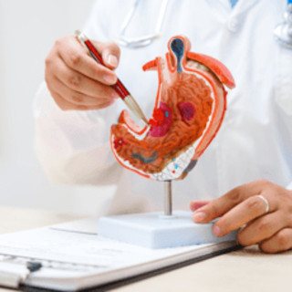 Cancro allo stomaco avanzato, nuova terapia riduce del 42% il rischio di morte Cancro allo stomaco avanzato, nuova terapia riduce del 42% il rischio di morte 