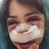 Bari, studentessa picchiata nei bagni denuncia nuovo episodio: "Mi hanno accerchiata" Bari, studentessa picchiata nei bagni denuncia nuovo episodio: "Mi hanno accerchiata"