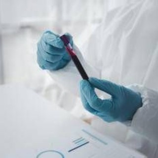 Epatite A in forte crescita in Italia: Lazio, Campania e Puglia le regioni con più casi