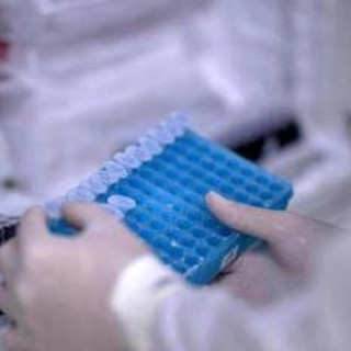 Melanoma, glicemia alta dimezza la sopravvivenza in pazienti senza diabete