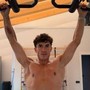 Marquez e la foto choc: il pilota mostra la spalla 'deformata'