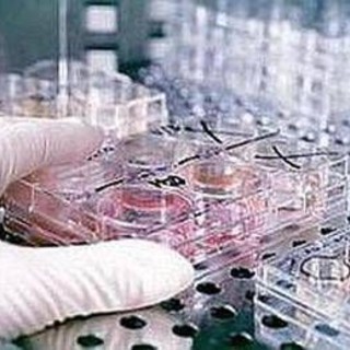 Fecondazione, non solo endometriosi: il nuovo protocllo che combatte l'adenomiosi