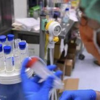 Legionella, a Milano sospetto focolaio: 11 casi con 1 morto in zona San Siro