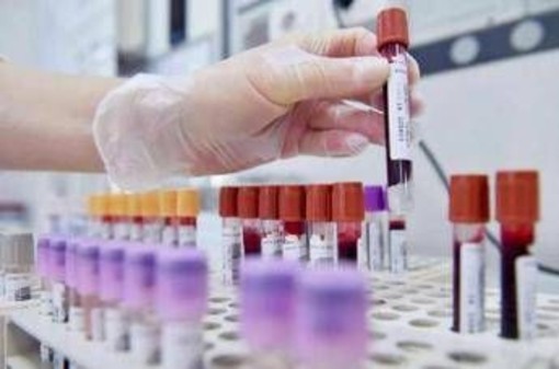 Sclerosi multipla recidivante, Ema raccomanda approvazione ocrelizumab dai 10 anni Sclerosi multipla recidivante, Ema raccomanda approvazione ocrelizumab dai 10 anni