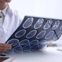 Sin: "Diagnosi più rapide e farmaci innovativi cambiano decorso sclerosi multipla" Sin: "Diagnosi più rapide e farmaci innovativi cambiano decorso sclerosi multipla"