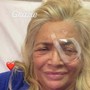 Mara Venier in ospedale e l'intervento all'occhio: "Chiudo l'anno così"