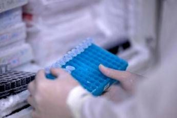 Scoperto il virus gigante Ushikuvirus, lo studio: "Può darci indizi su origine della vita"