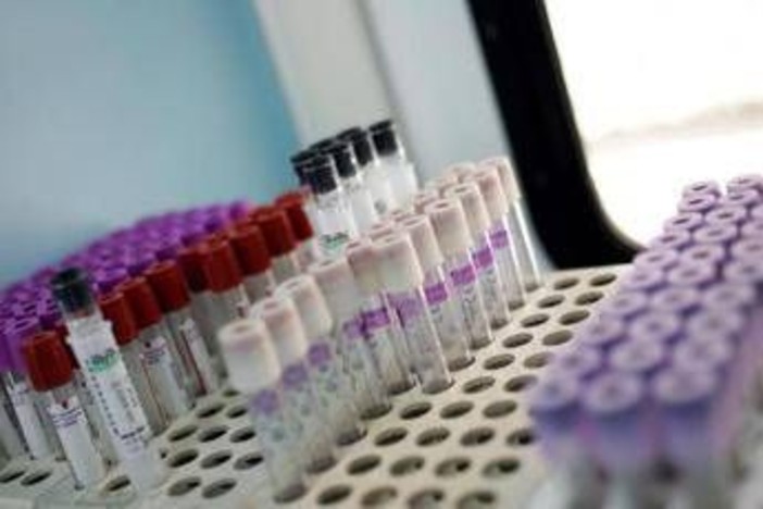 Mielofibrosi, speranze da nuovo farmaco che limita l'anemia in 2 pazienti su 3