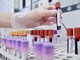 Cancro al seno, oncologi: &quot;Bene test genomici nei nuovi Lea, fare presto&quot;