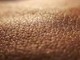 Dermatite atopica, quando la pelle condiziona la vita, 'Diari atipici' dà voce ai pazienti Dermatite atopica, quando la pelle condiziona la vita, 'Diari atipici' dà voce ai pazienti