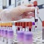 Sclerosi multipla recidivante, Ema raccomanda approvazione ocrelizumab dai 10 anni Sclerosi multipla recidivante, Ema raccomanda approvazione ocrelizumab dai 10 anni