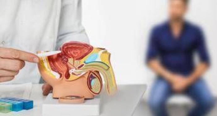 Tumori, 485mila italiani con cancro prostata, Aiom: &quot;Casi in crescita, potenziare prevenzione&quot;