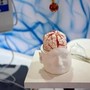 Dai gliomi al Parkinson, così l’intelligenza artificiale aiuta la Neurochirurgia Dai gliomi al Parkinson, così l’intelligenza artificiale aiuta la Neurochirurgia