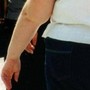 Salute: allerta endocrinologi, obesità triplicata in donne e raddoppiata in uomini