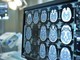 Telemedicina, progetto telestroke permette di trattare ictus a distanza